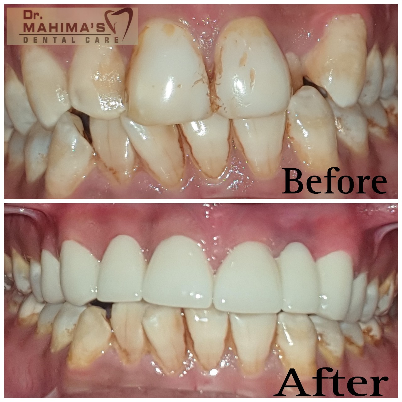 Before smile design treatment